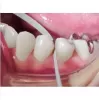 Diamond strip, fine