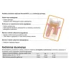 Harvard MTA Universal 1 g + 3 ml