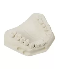 Type II plasters