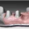 A silicone Gingifast CAD rigid, 2 x 50 ml