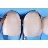 Matrices for anterior restorations Unica anterior, 50 pcs.