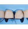 Matrices for anterior restorations Unica anterior, 50 pcs.