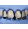 Matrix Unica anterior minideep, 50 pcs.