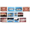 Unica Proximal Anterior matrices, deep, 0,03 mm thick, 100 pcs.