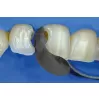 Sectional matrices QuickmatFLEX Molar, 6.4 mm, 100 pcs.