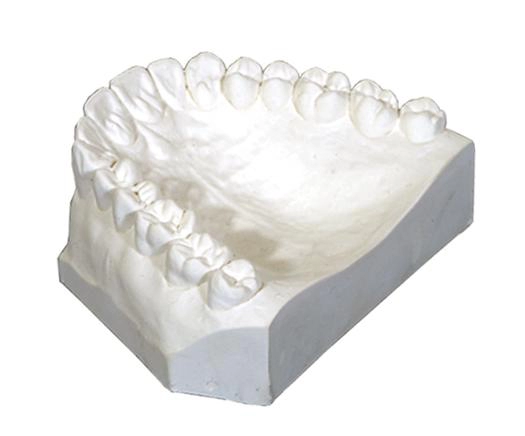 Gipsas Orthoplaster III klasės, 1 kg